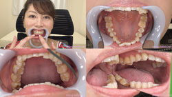 【歯フェチ】翔田千里さんの歯を観察しました！