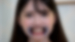Rika-chan&#39;s mouth opening device, interview