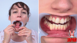 Dental Examination with Clara LUROA
