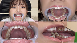 [Teeth fetish] I observed Suzuki Mayu&#39;s teeth!