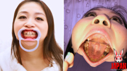 Dental Exploration: Rin Suzumiya's Oral Adventure