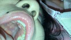 White folds of upper jaw, yellowed teeth, well-formed nose hair Karen③ KITR00235