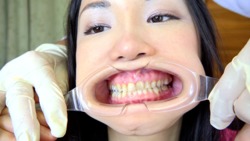 [牙齒神物＃1]新的口內觀察 - 口腔隱士的TANIMOTO（X博士）