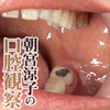 Beauty intraoral ripe mature woman-morning Suzumiya Ryoko （ teeth and throat UIA ） close-up observation.