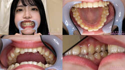 【치아 페티쉬】 미나세 아카리의 이빨을 관찰했습니다!