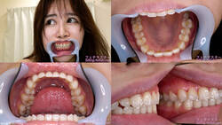 【치아 페티쉬】하즈키 미네 짱의 치아를 관찰했습니다!