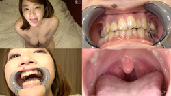 [Mouth/teeth] Observation of popular model Mai Arimura&#39;s throat, tongue tongue, teeth, and mouth! ! !